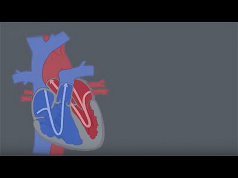 Congestive Heart Failure: What Is It?