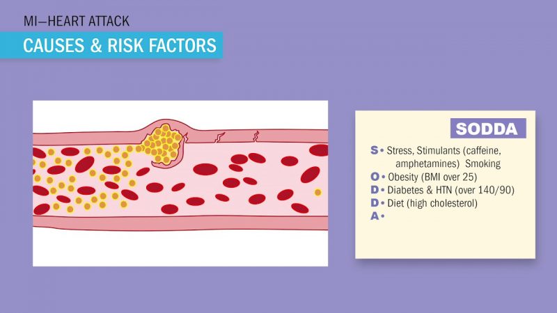 MI | Coronary Artery Disease (Atherosclerosis, ACS, & CAD) | Oruen