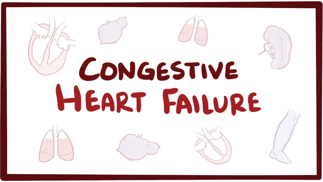 Congestive heart failure (CHF) – systolic, diastolic, left side, right side, & symptoms